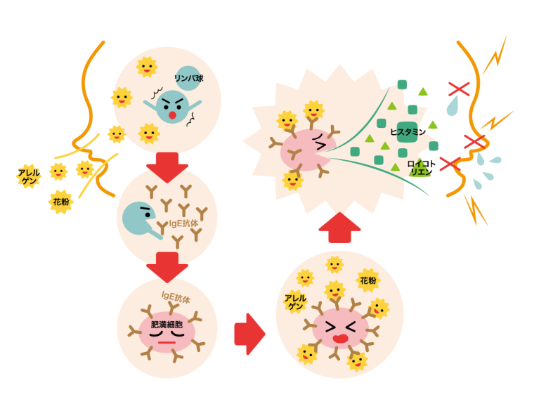 アレルギーとは