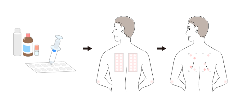 パッチテストのやり方